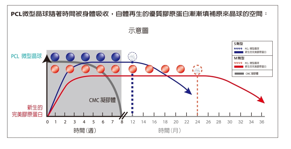 Ellansé洢蓮絲注射 膠原蛋白 自然提拉